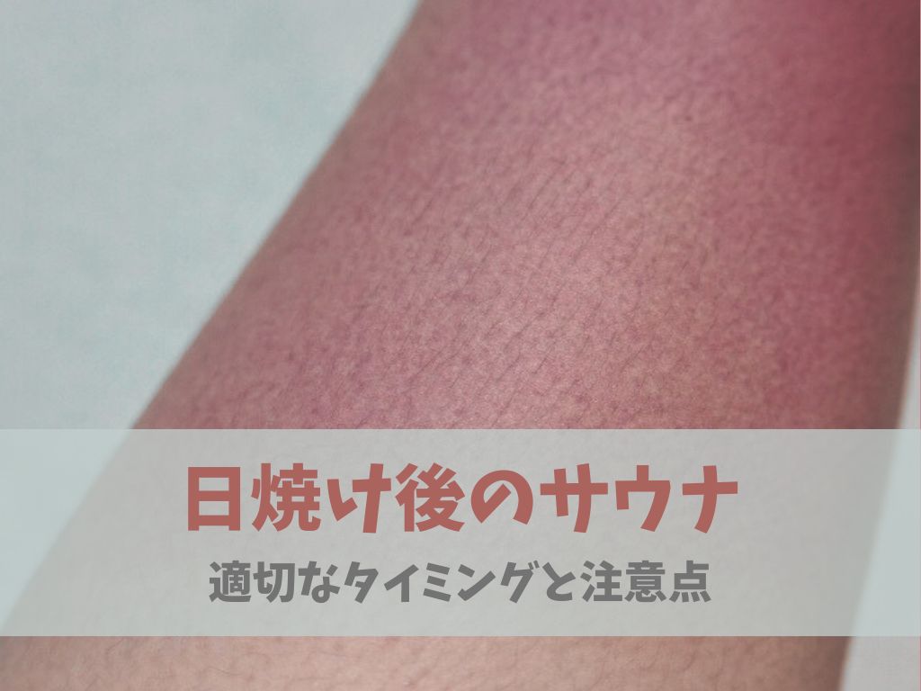 日焼けした後のサウナについて：適切なタイミングと注意点